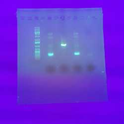 Bakterien der Spur: Leistungsfach Biologie forscht im Labor