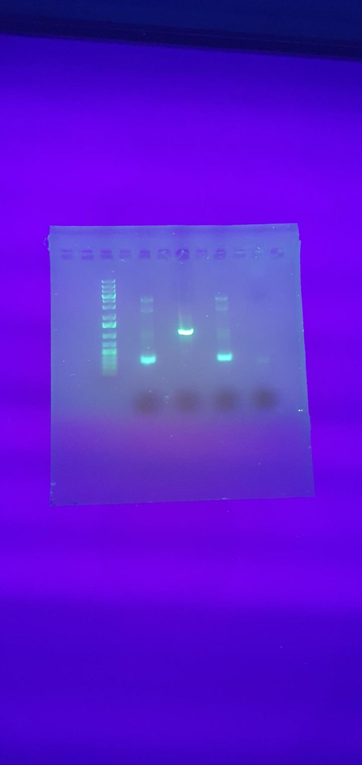 auswertung_gelektrophorese.jpeg